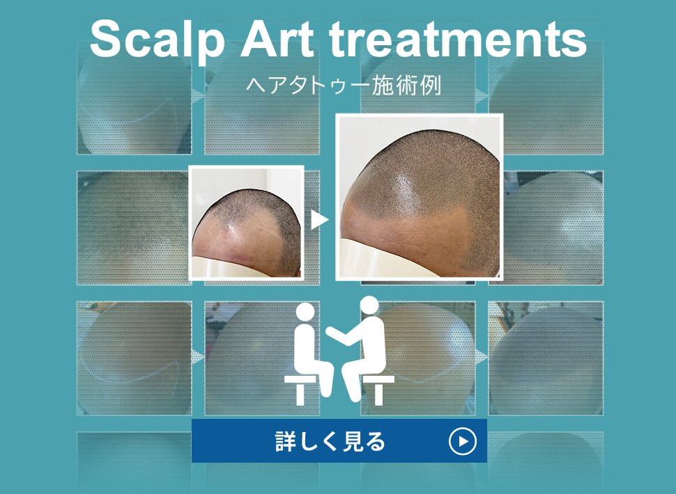 Scalp Art treatments
