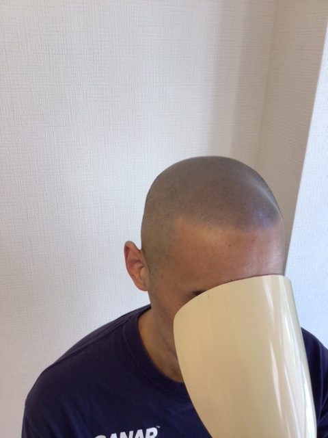 【４年後のヘアタトゥー】この写真は0.5mmカットです。メンテナンスは必要ないかな？とも思います。