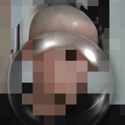 【アフター】柔らかい雰囲気のヘアタトゥーです。