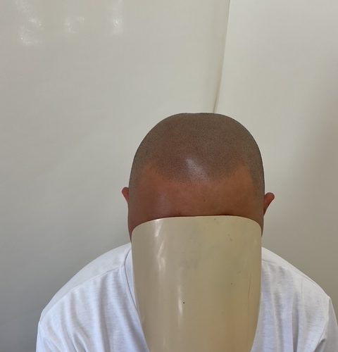 【アフター】フロントはやや薄めにしてボカシ気味です。頭頂部は存在感ある色味にしました。